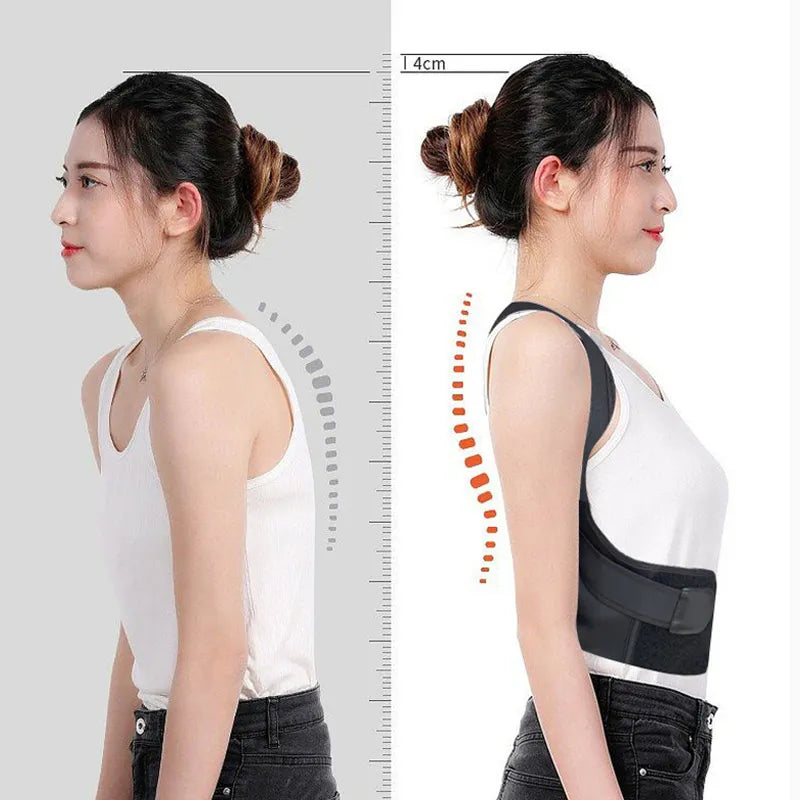 Posture Corrector Back Support Comfortable Back and Shoulder Brace for Men and Women Medical Device To Improve Bad Posture Belt - Gym&Gadgets